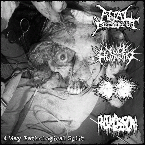 Anal Disfigurement : 4 Way Pathological Split